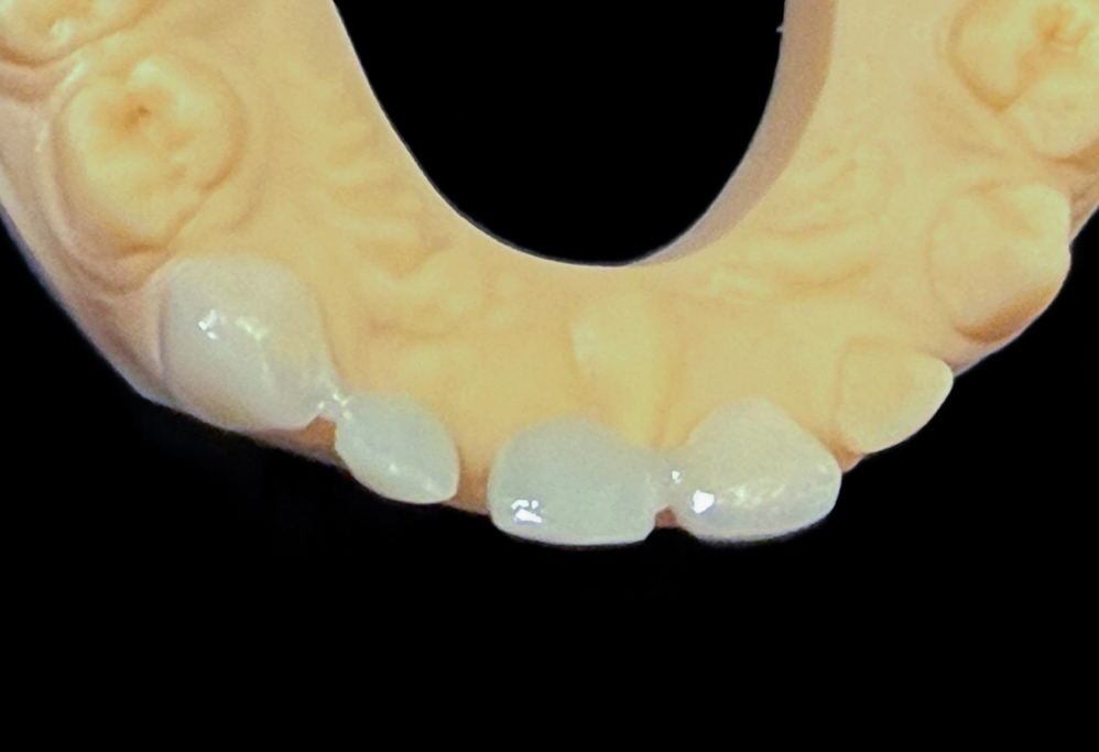 sheskin-6