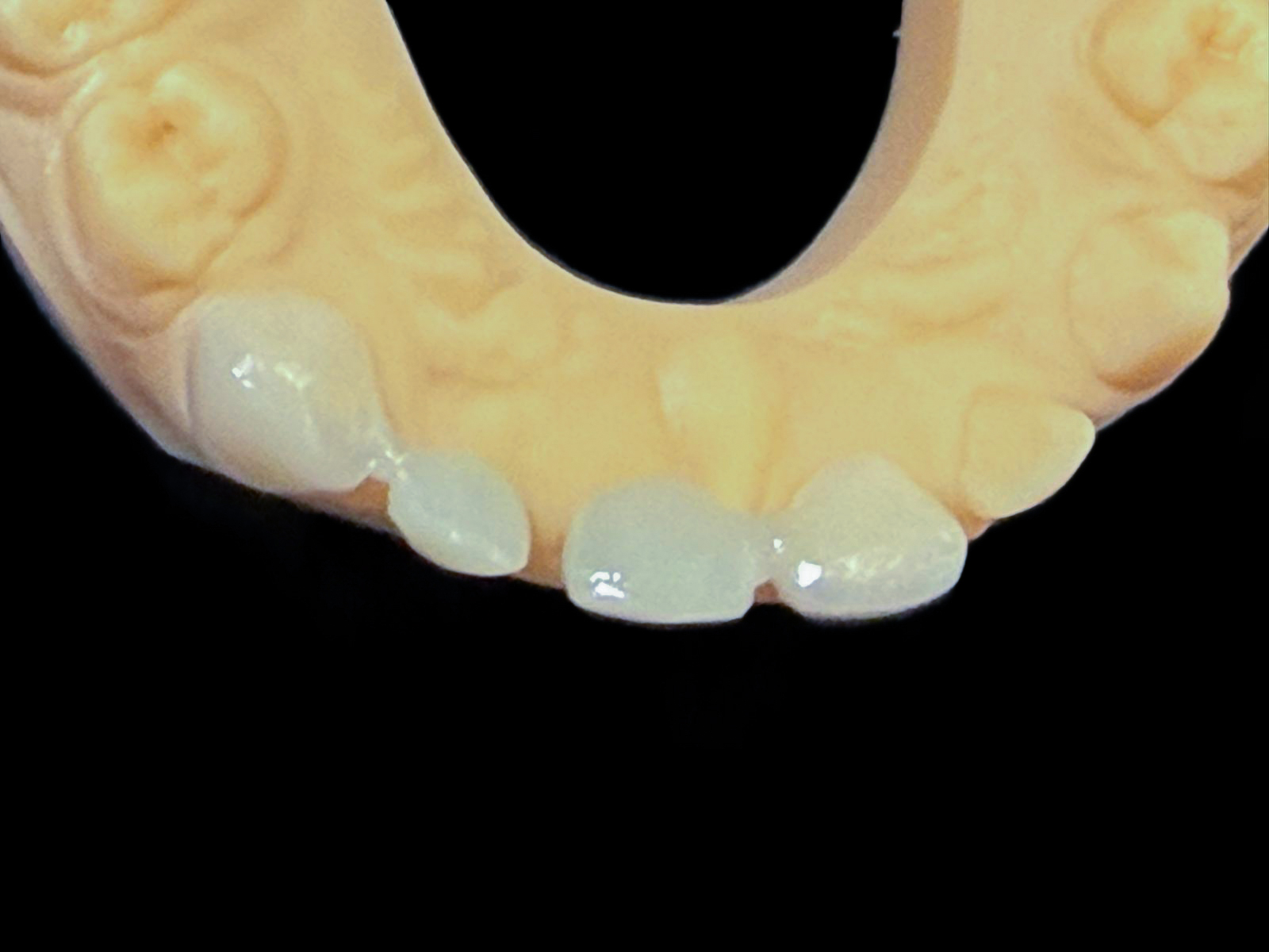 sheskin-6